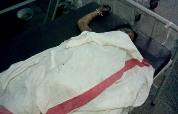 Burned housewife died in Gomati Dist. Hospital